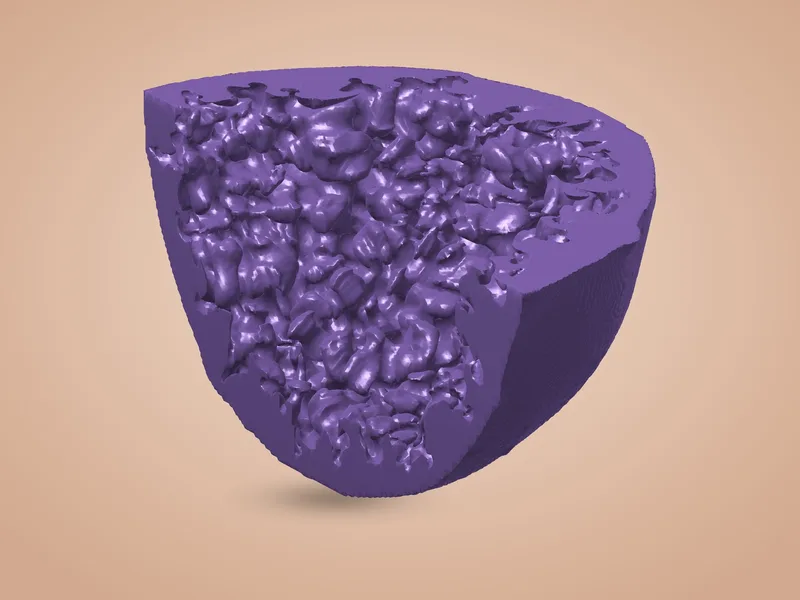 Onde de choc (quart de globe)