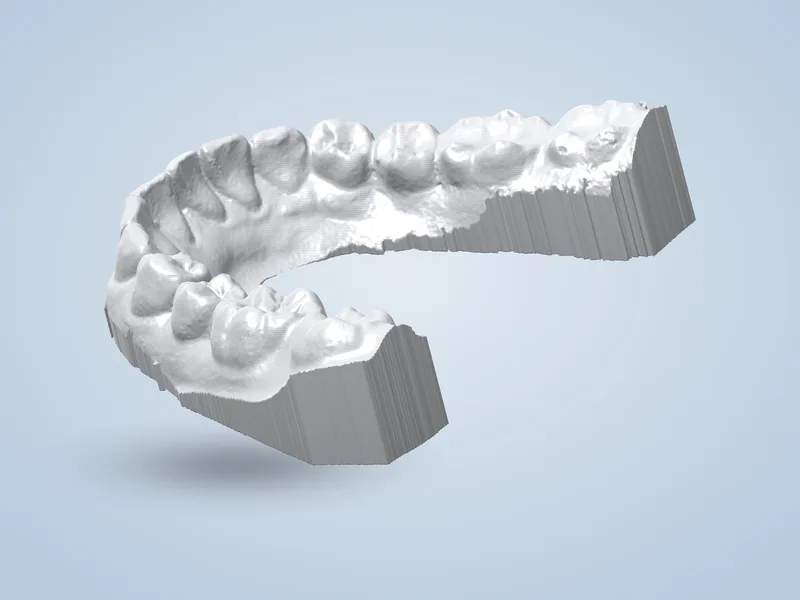 Dental Model: Lower Teeth