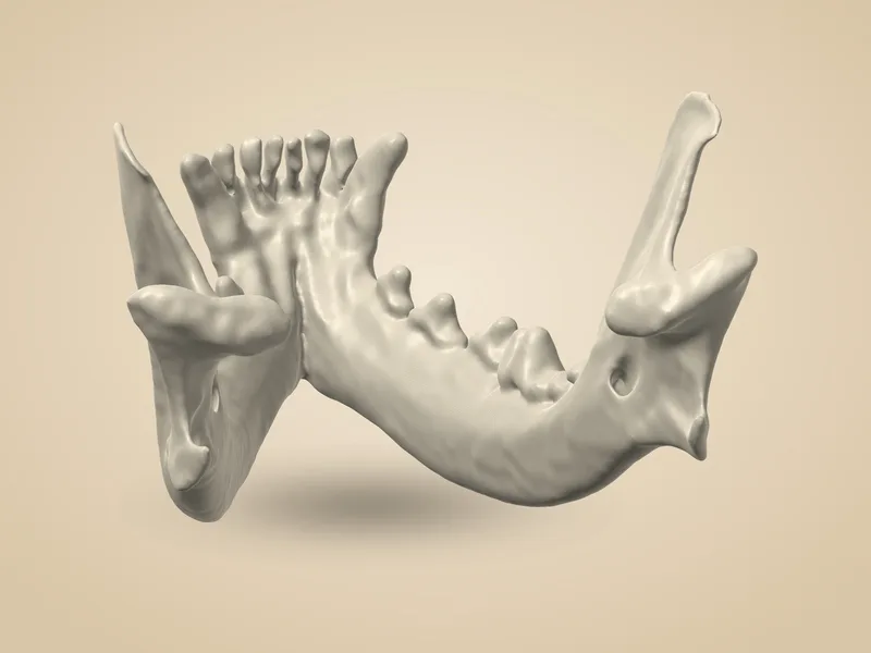 Jaw