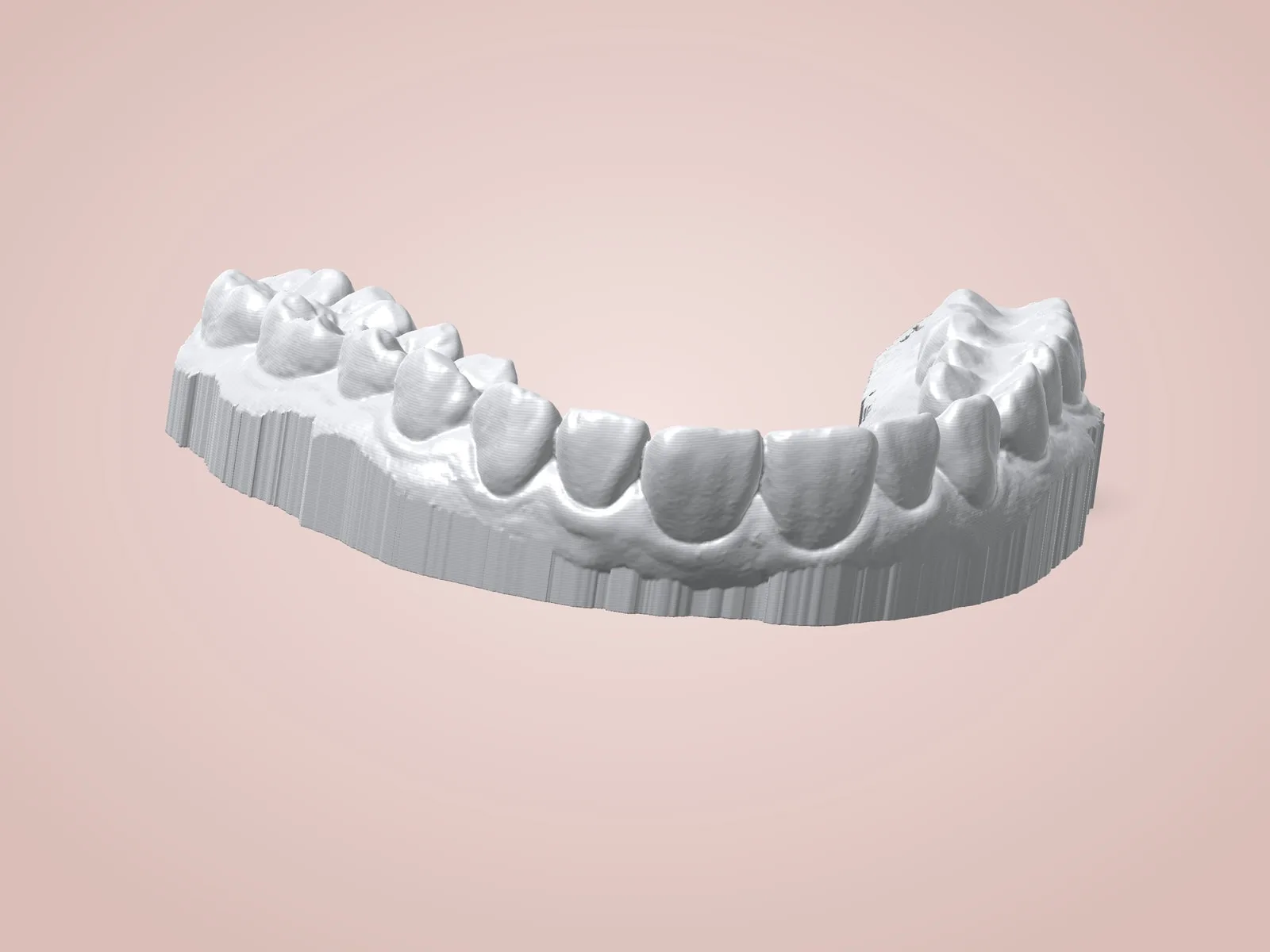 Dental Model: Upper Teeth